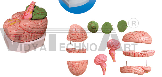 The model of brain and cerebral arteries distributing